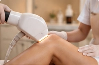 Épilation laser sur la jambe d’une cliente